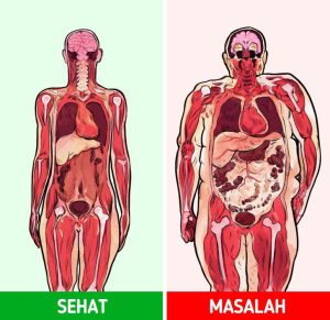 Bahaya Lemak Perut Terhadap Risiko Serangan Jantung Memahami Ancaman Tersembunyi Di Balik Lingkar Pinggang